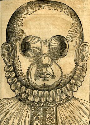 Strabismus Masks