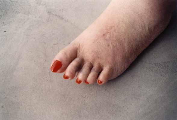 Foot from the series Natural Causes